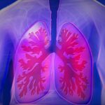 UK researchers praise a “wonderful” new treatment for the deadly cancer mesothelioma, which is linked to asbestos.